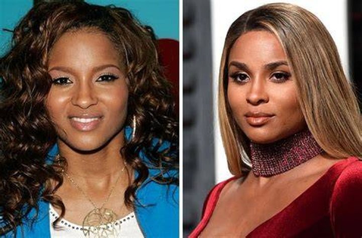 Ciara Nose Job Plastic Surgery Before and After