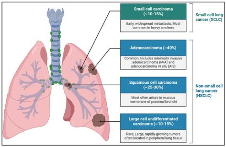 Clinical Challenges: Small Cell Lung Cancer