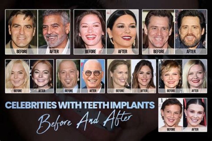 Did Kelsey Get Implants? – Celebrity