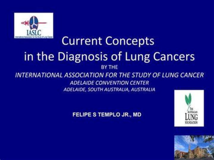 Lung Cancer | Current Concepts and Recent Advances in Oncology Part 1: Lung Cancer